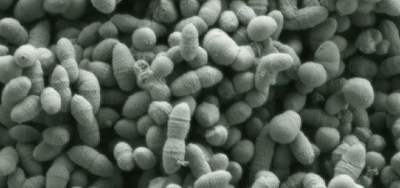 Ruminococcus-gnavus